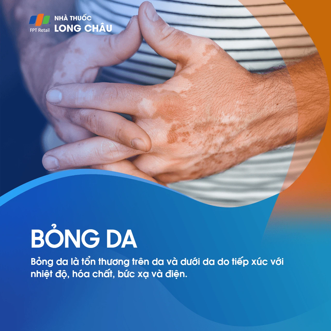 Bỏng da 1