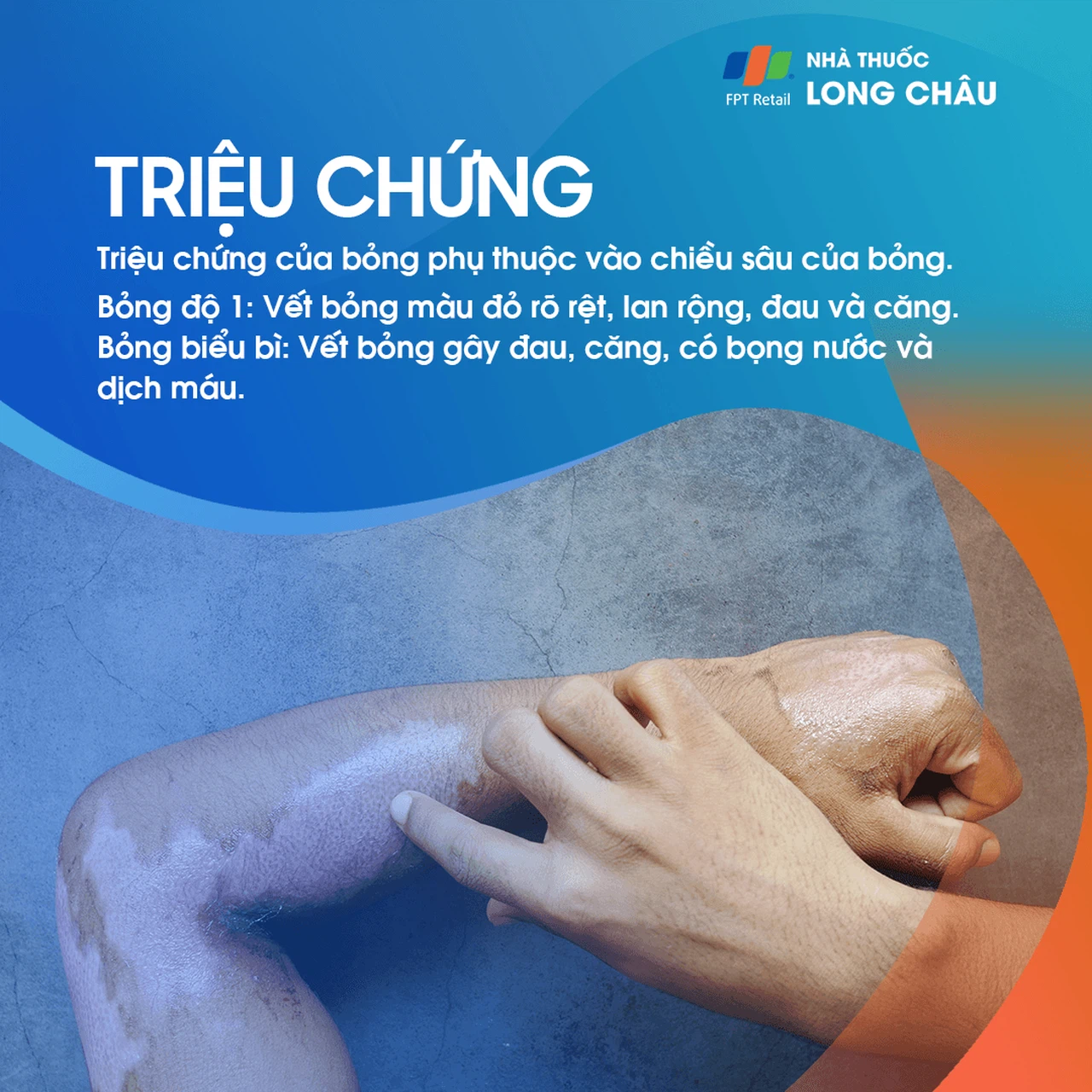 Bỏng da 3