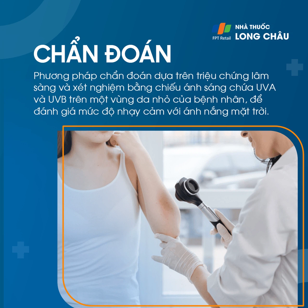 Bỏng nắng 5