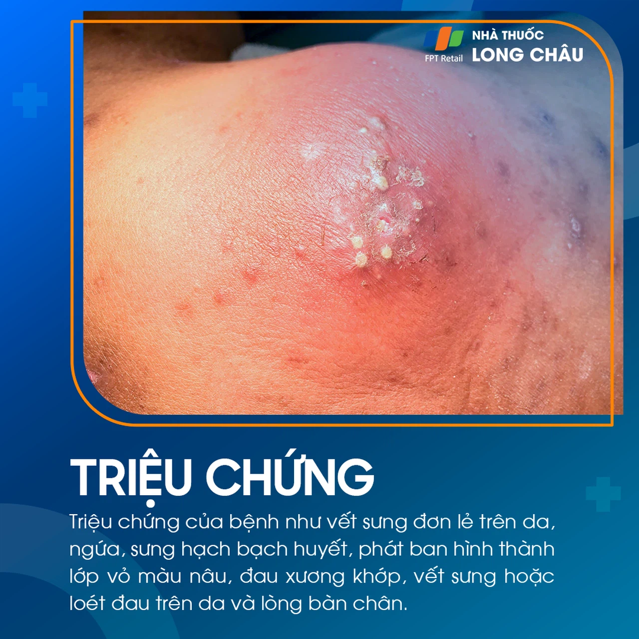 Ghẻ cóc 2