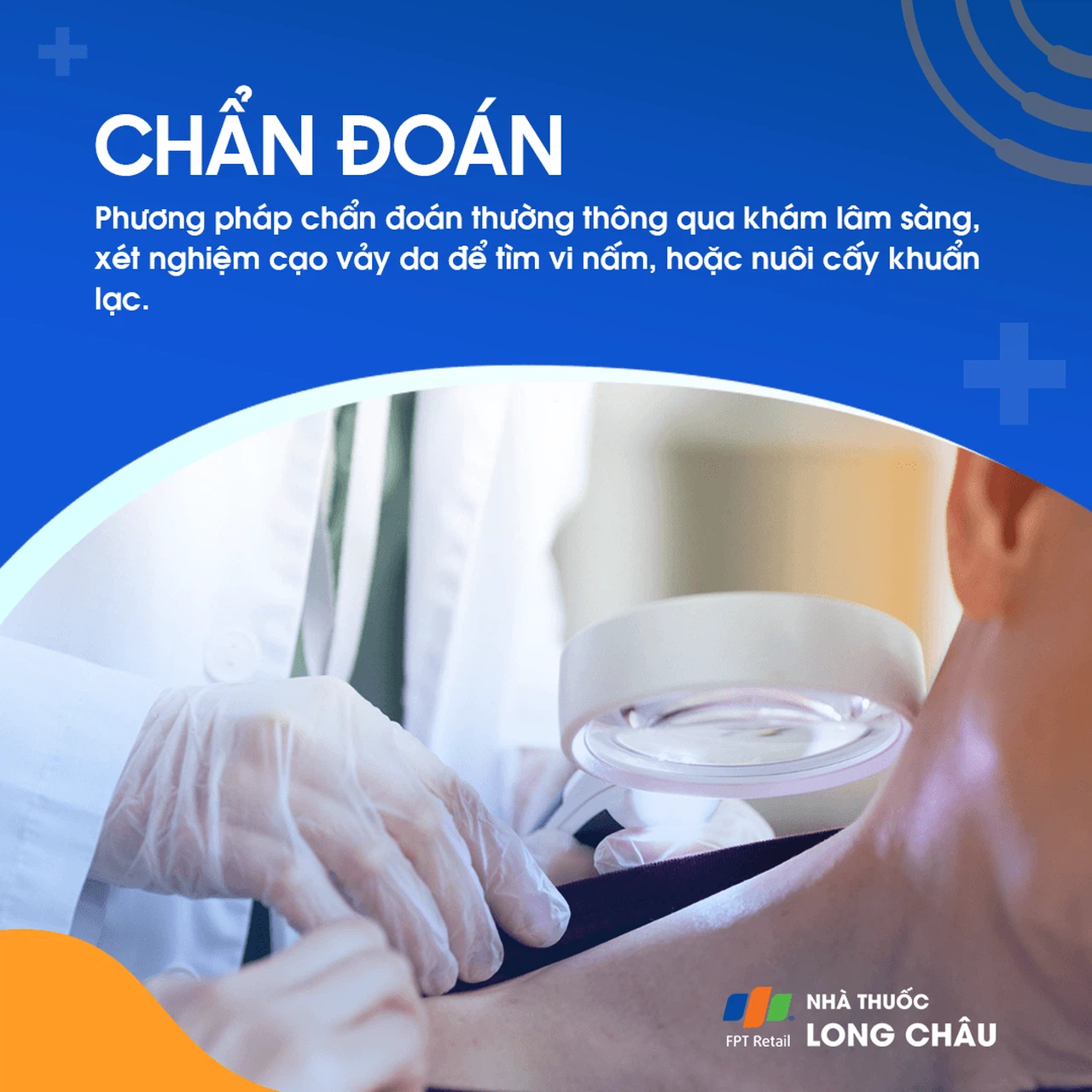 Hắc lào 5