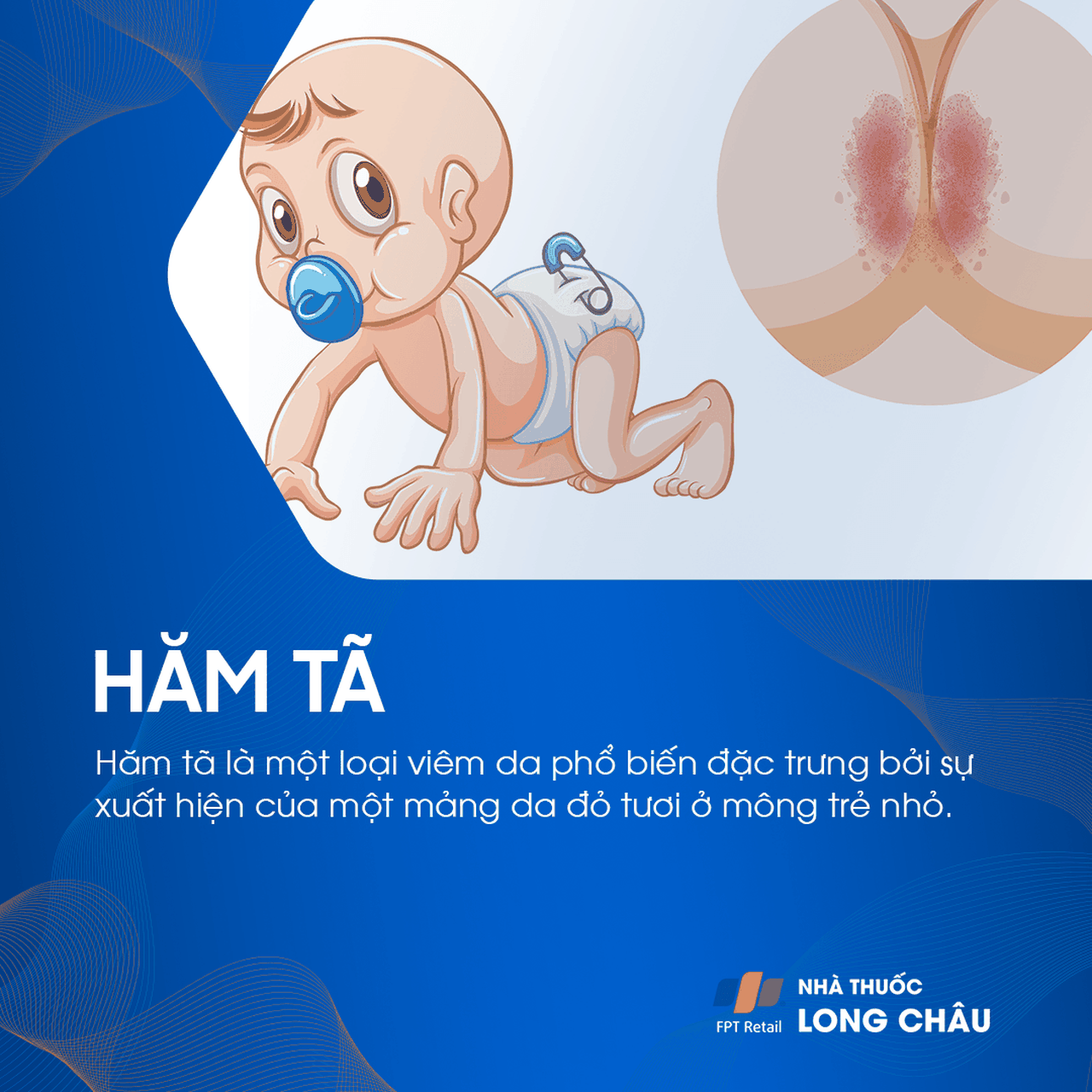 Hăm Tã 1
