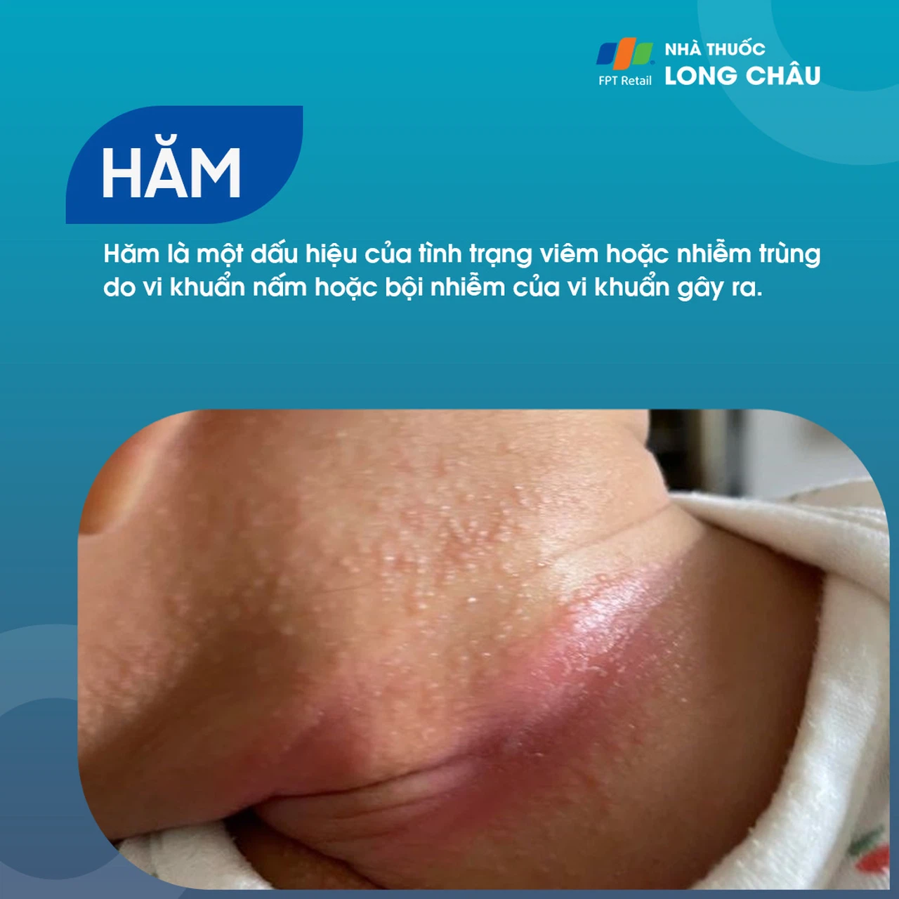 Hăm 1