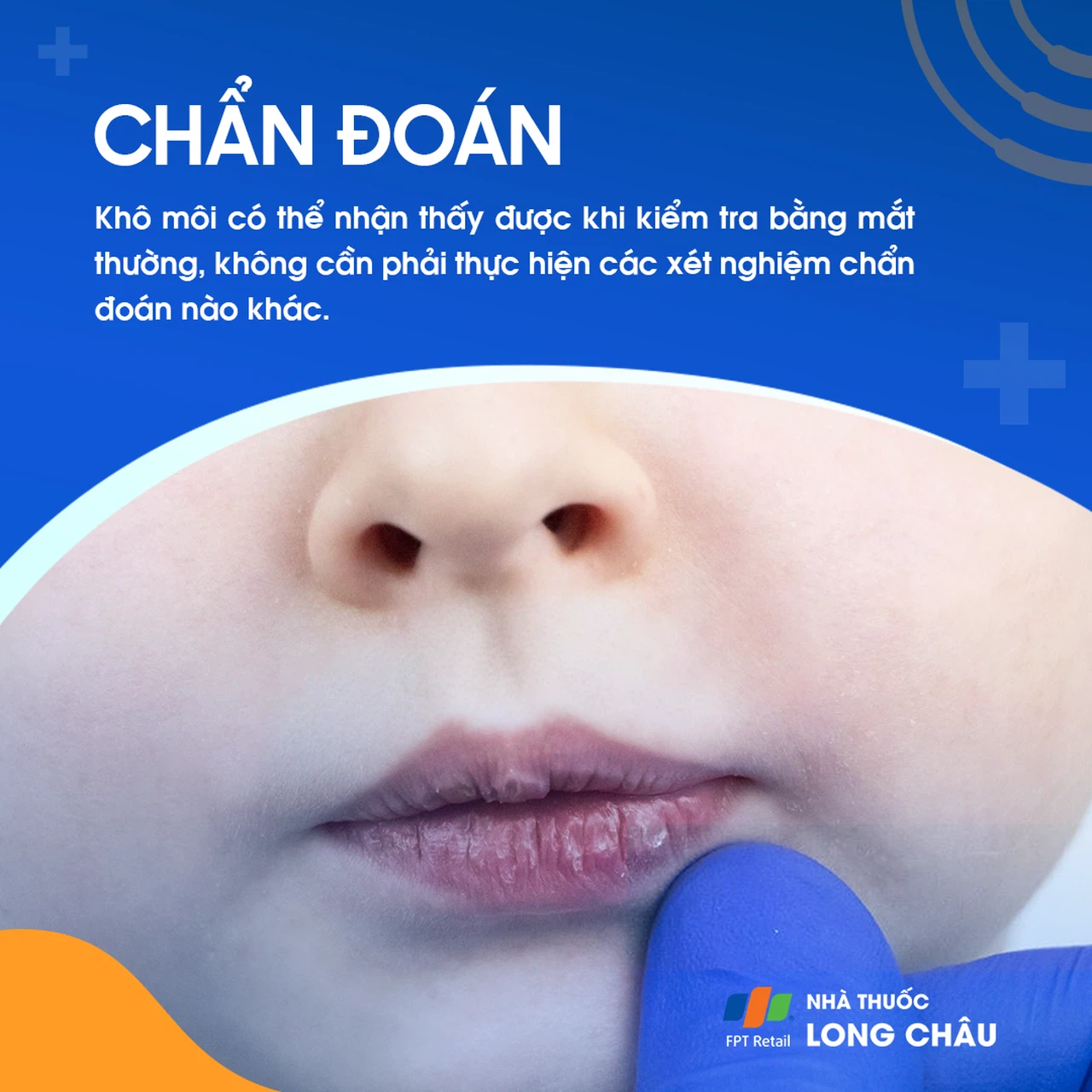 kiểm tra tình trạng khô môi tại phòng khám da liễu