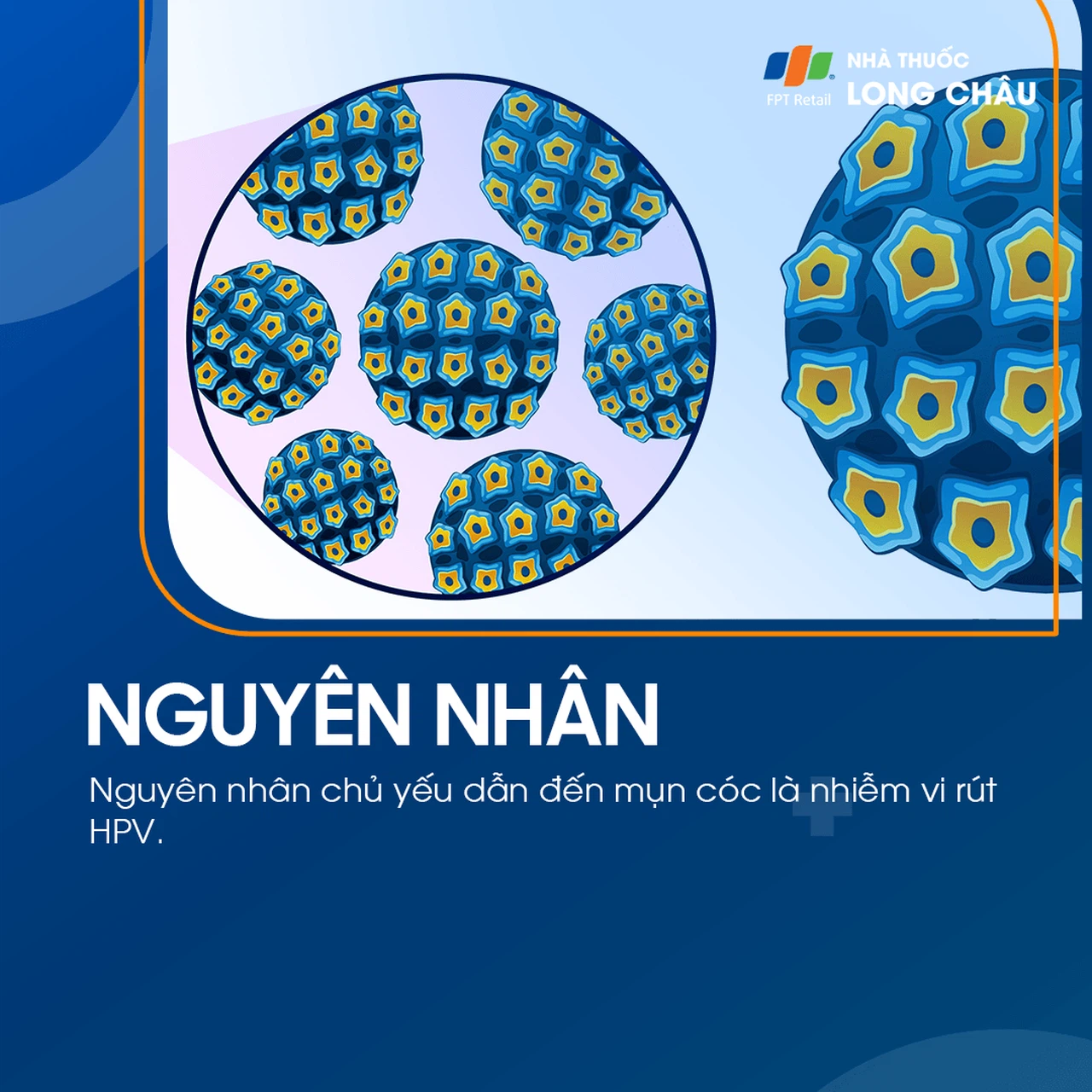 Mụn cóc 3