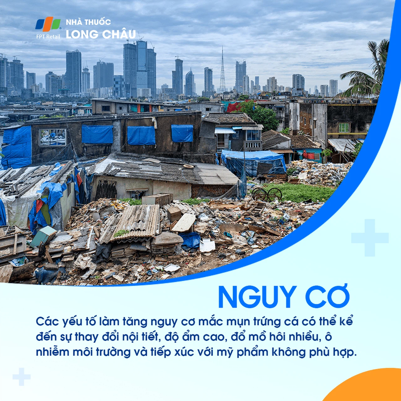 Mụn trứng cá 4
