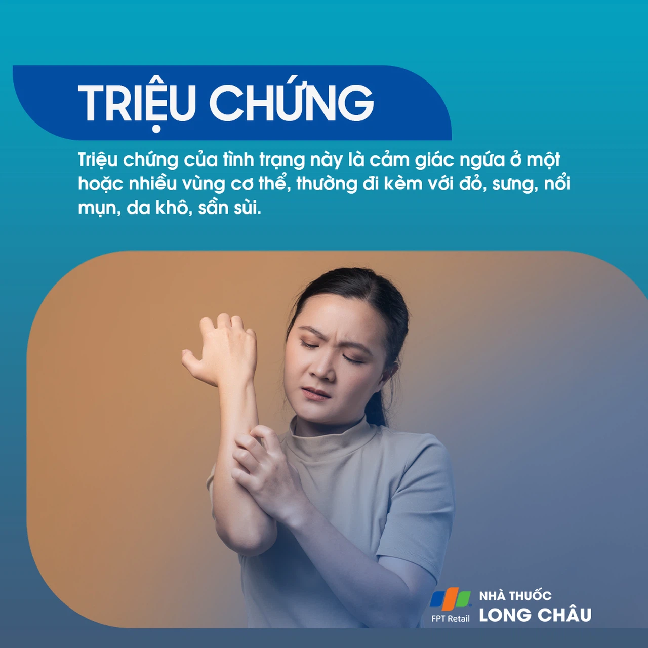 tình trạng ngứa da là sự đỏ lên và bong tróc trên bề mặt da