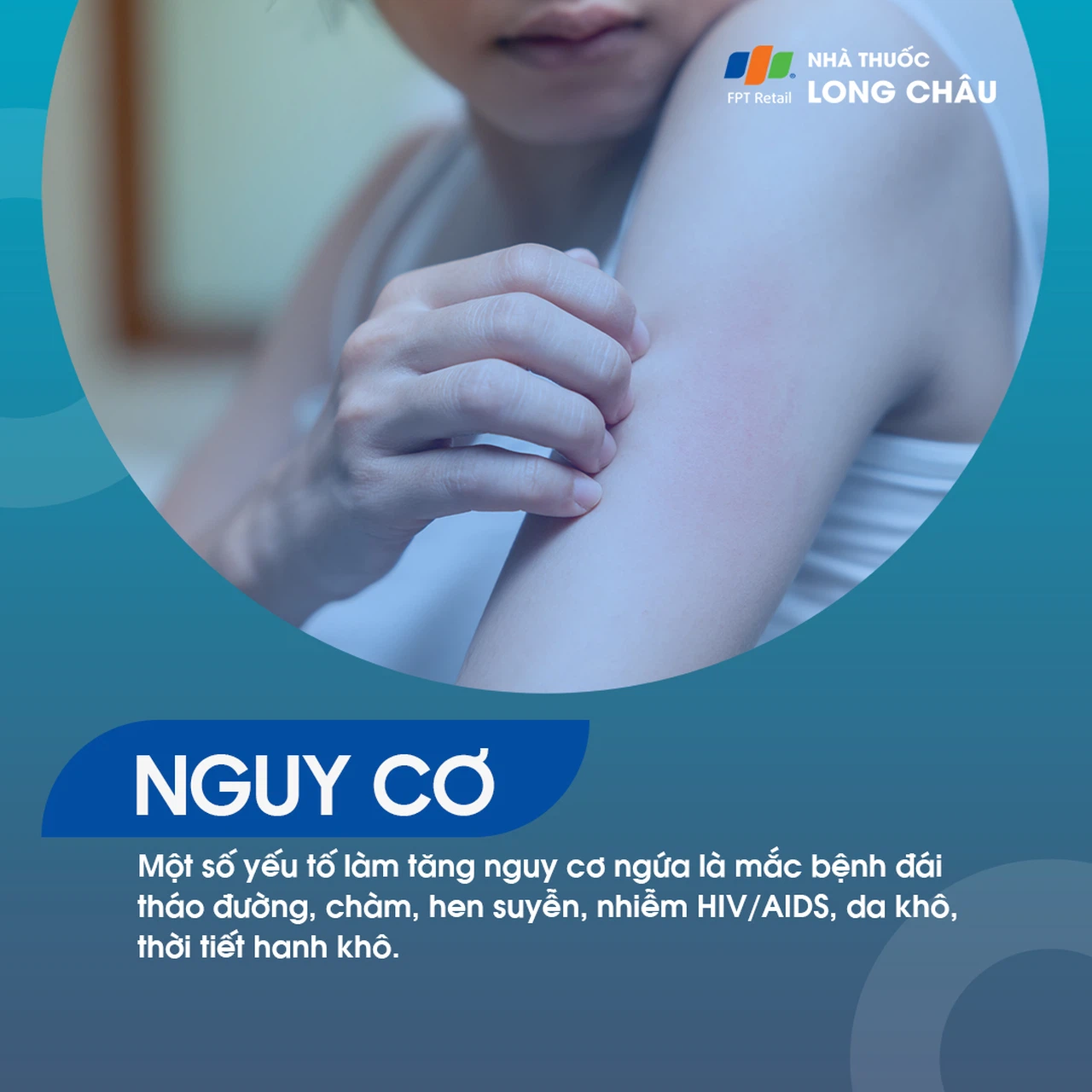 Một số yếu tố làm tăng nguy cơ ngứa