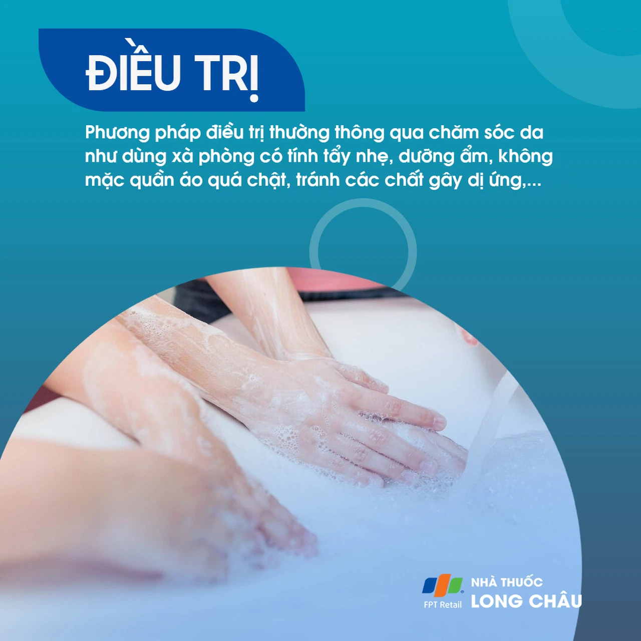 Phương pháp điều trị ngứa da hiệu quả bằng cách sử dụng kem dưỡng ẩm và thuốc chống dị ứng