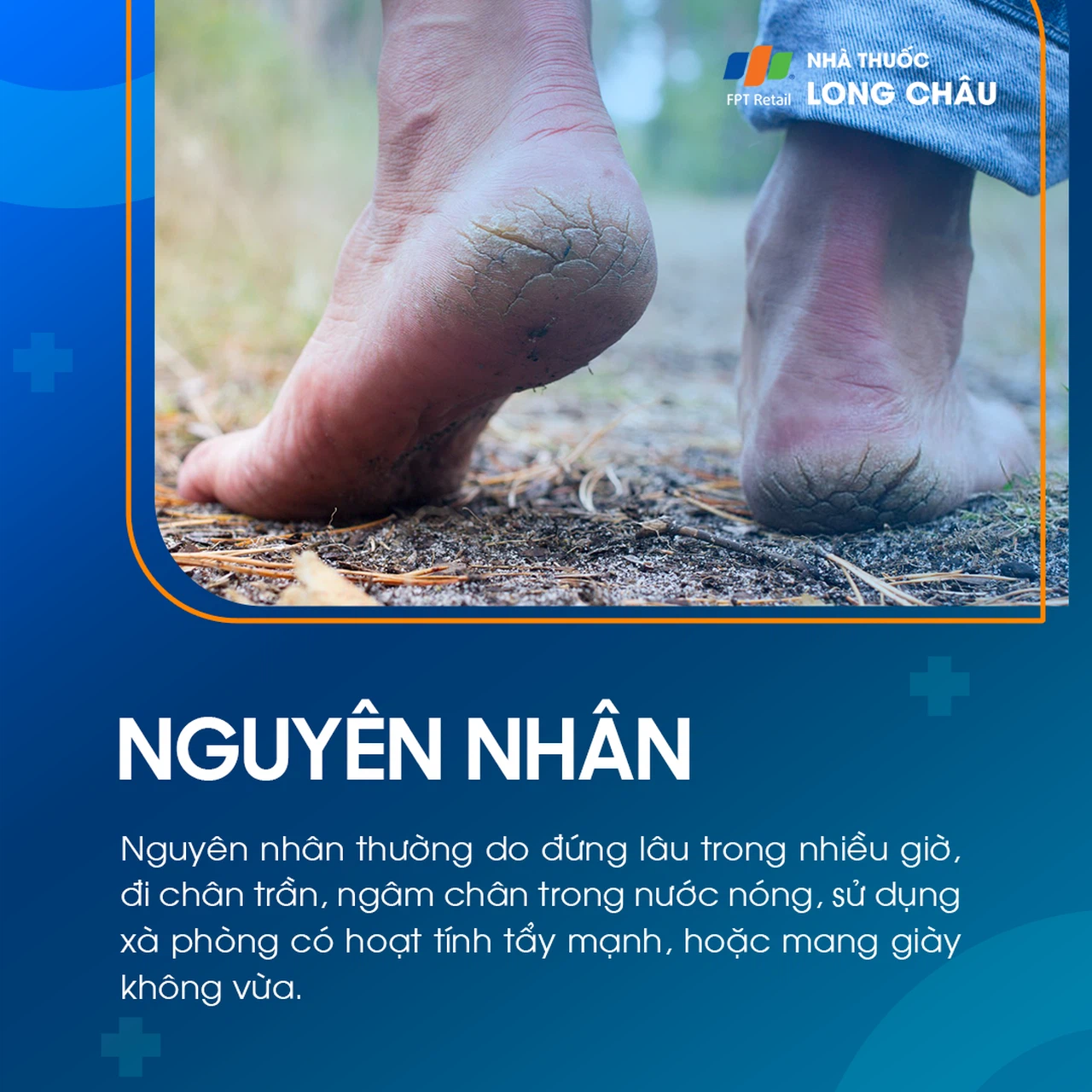 Nứt Gót Chân 3