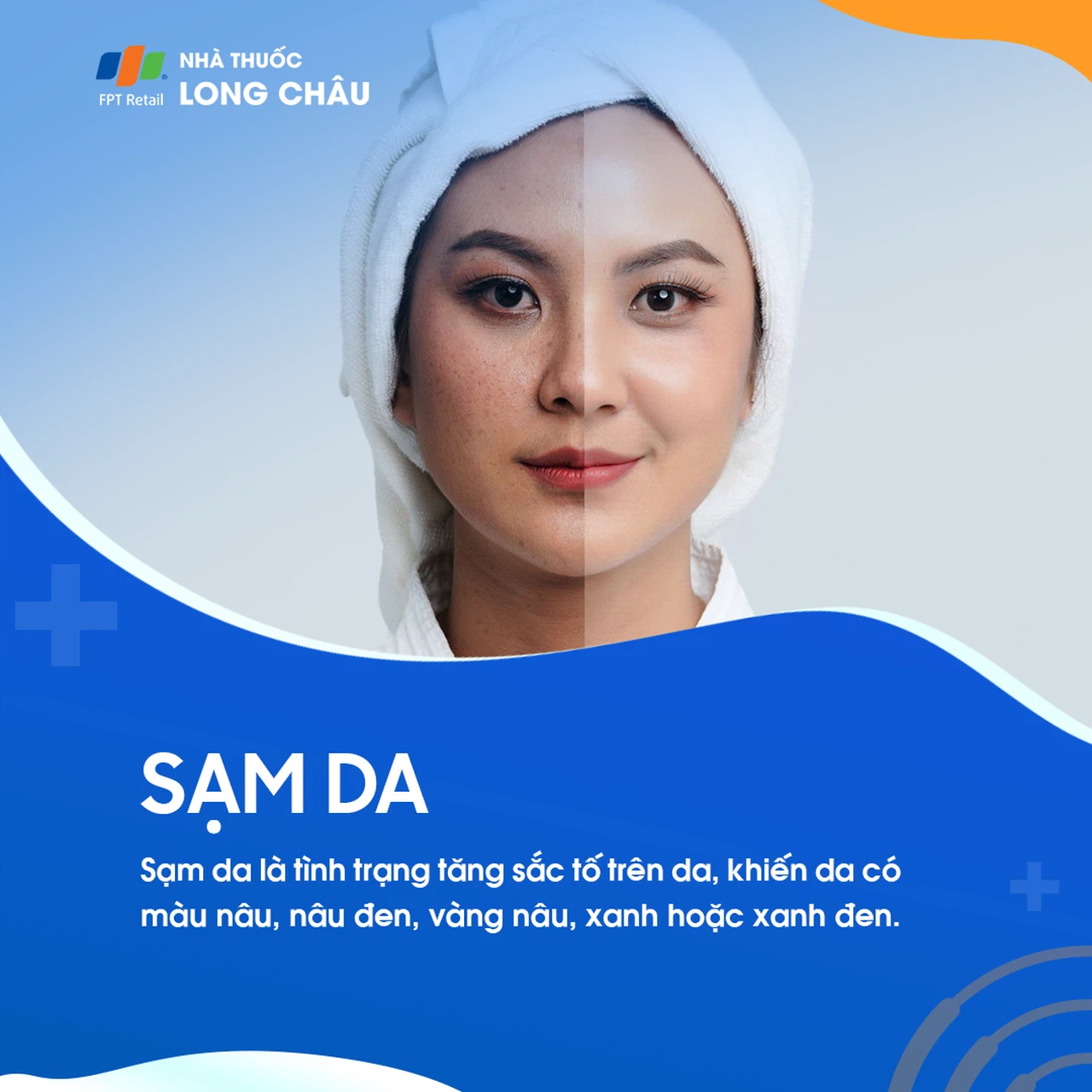 Sạm da 1