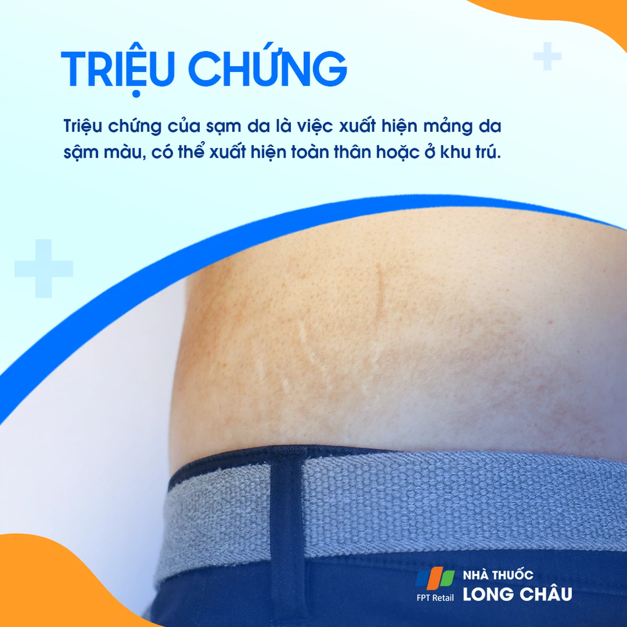 Sạm da 2