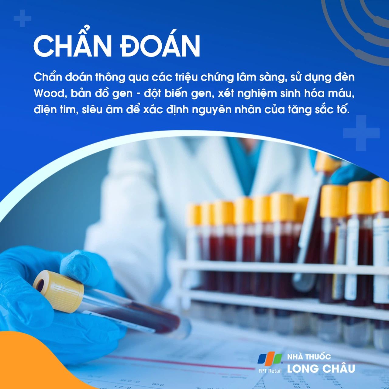Sạm da 5