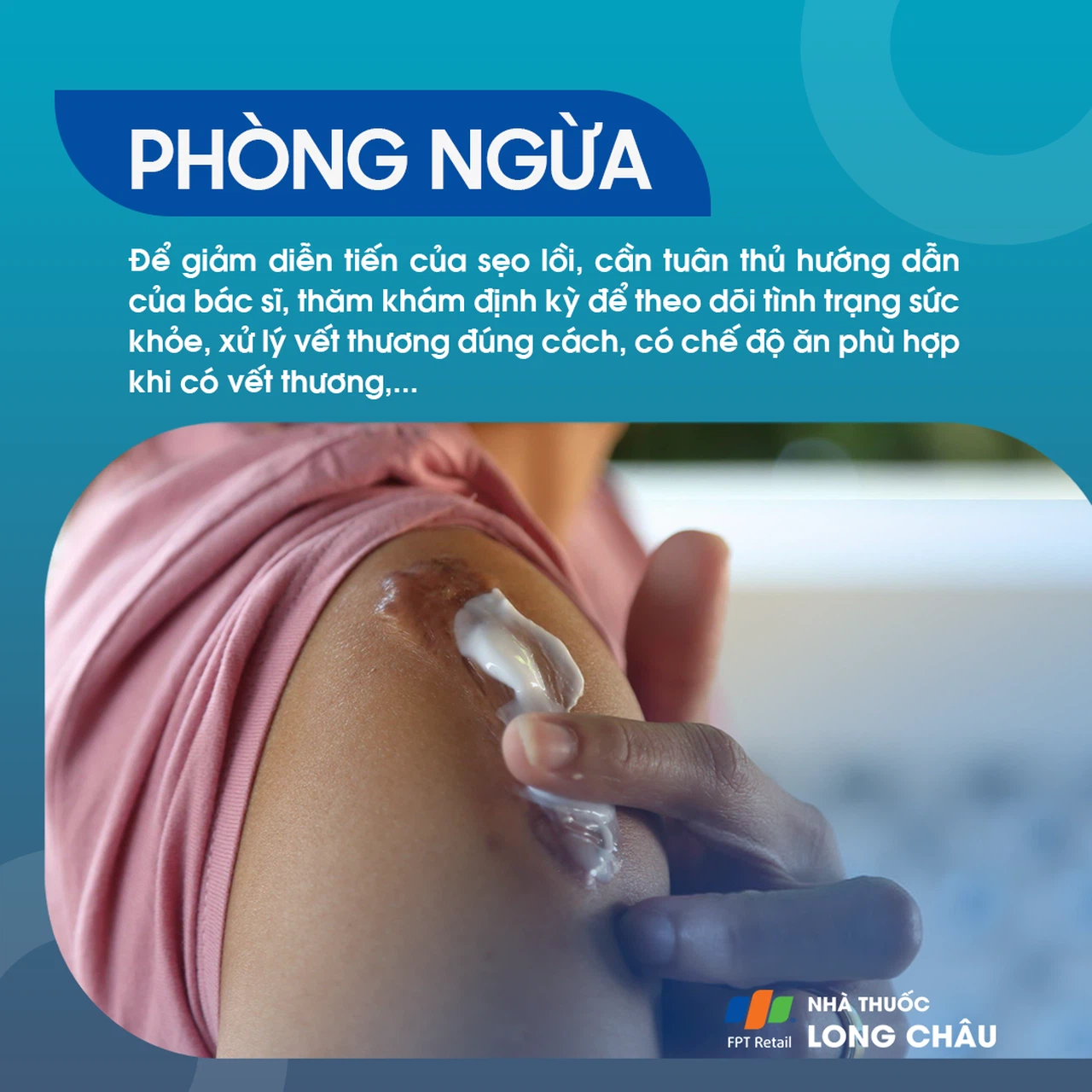 Sẹo Lồi 7