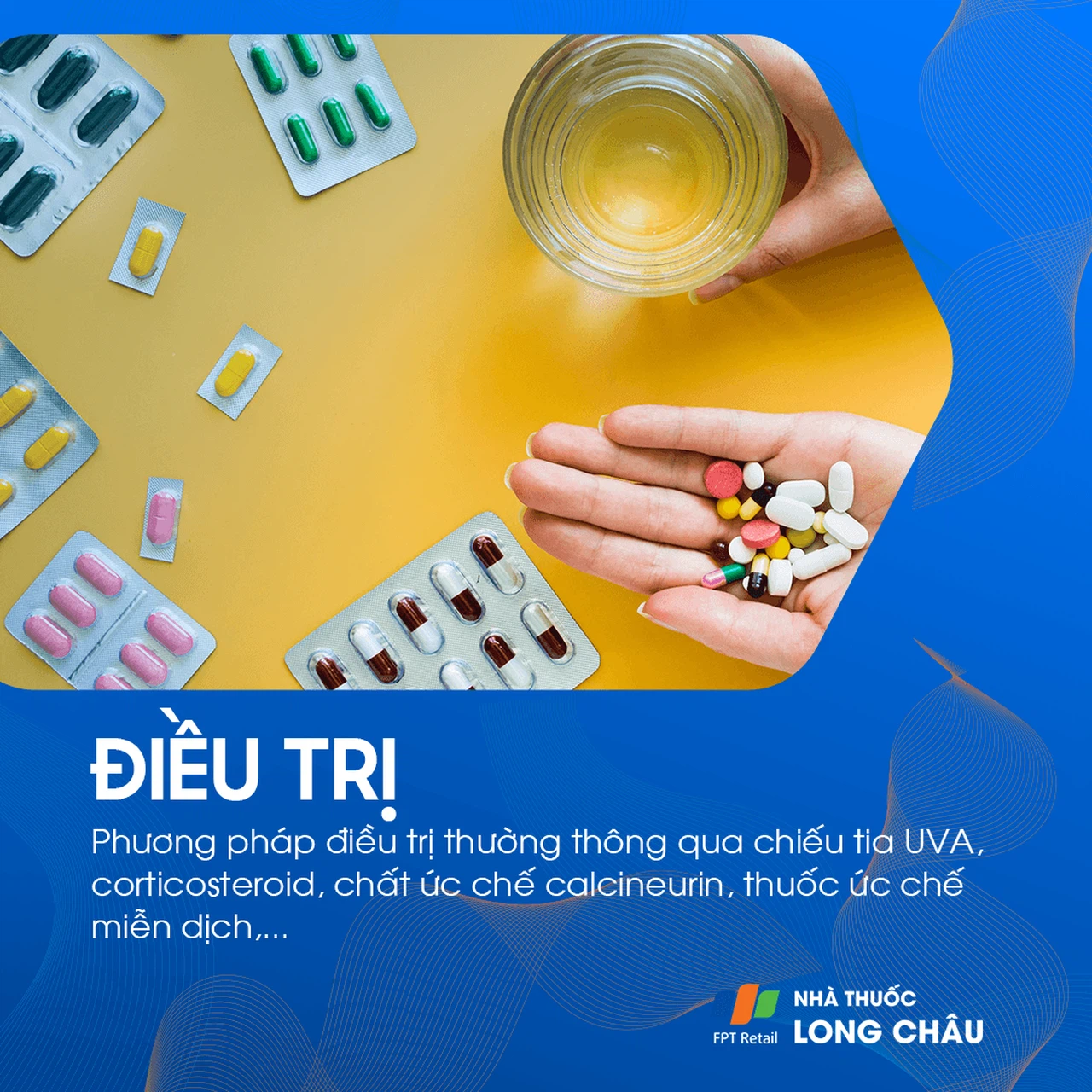 Điều trị bệnh tổ đỉa bằng cách sử dụng kem bôi steroid để giảm viêm và ngứa