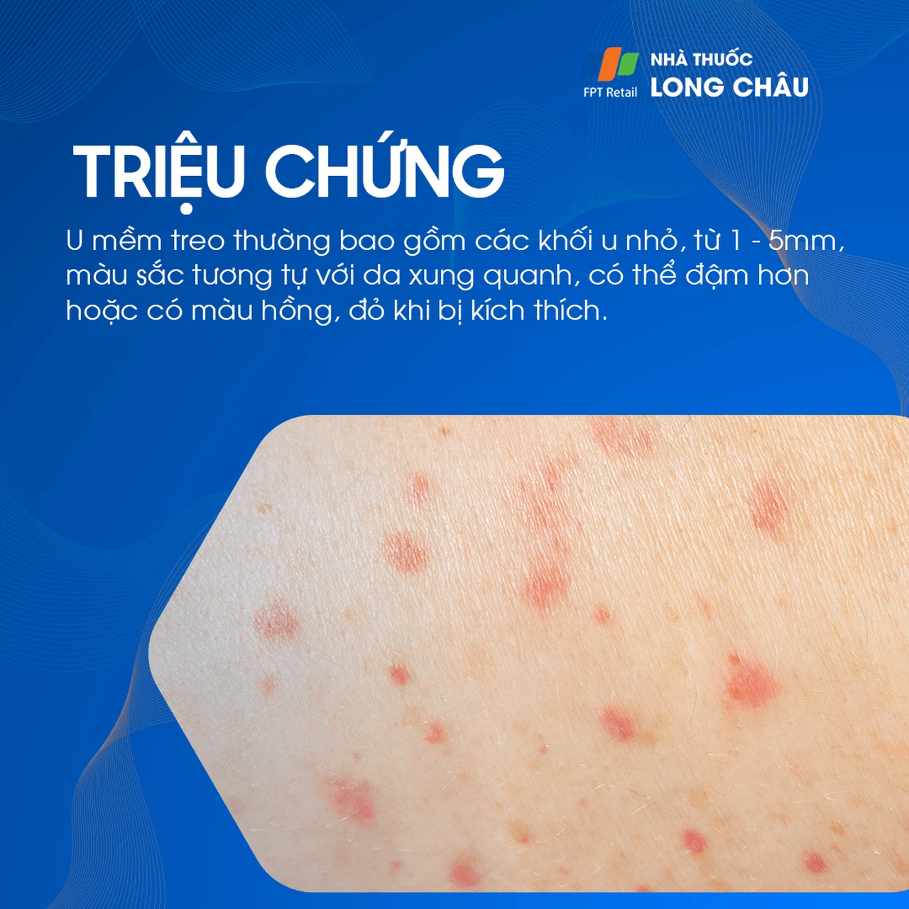 U Mềm Treo 2