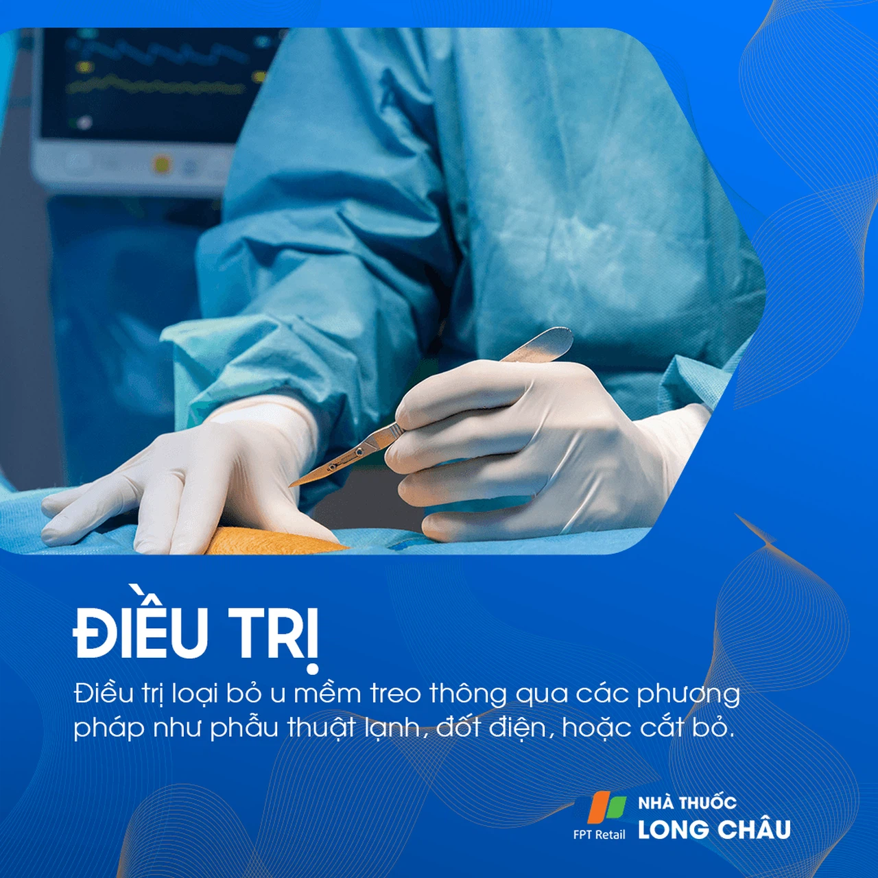 U Mềm Treo 6