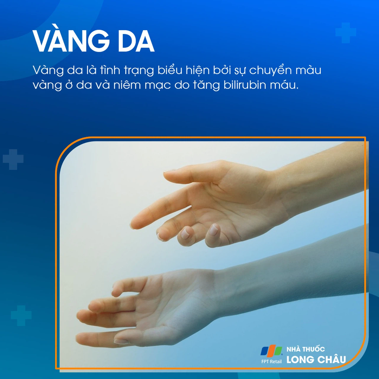 Vàng Da 1
