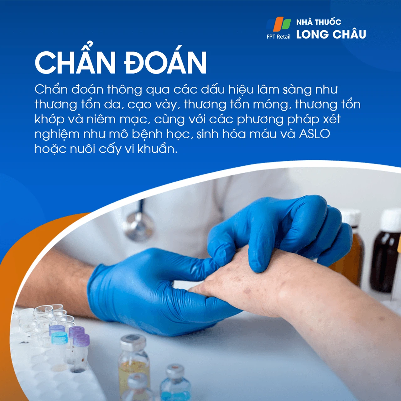 Vảy nến 5