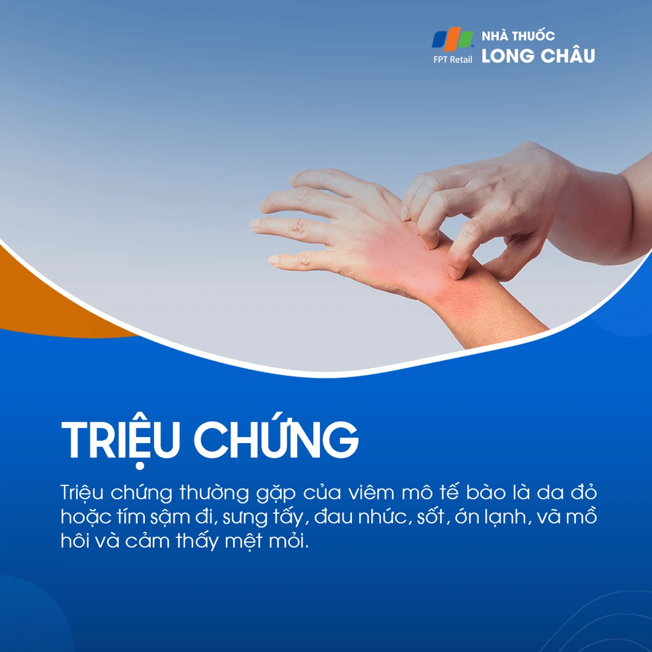 Viêm Mô Tế Bào 2