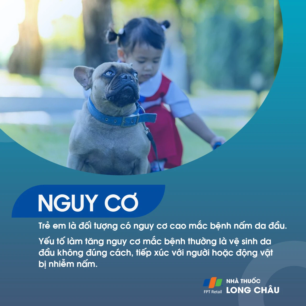 Nấm Da Đầu 4