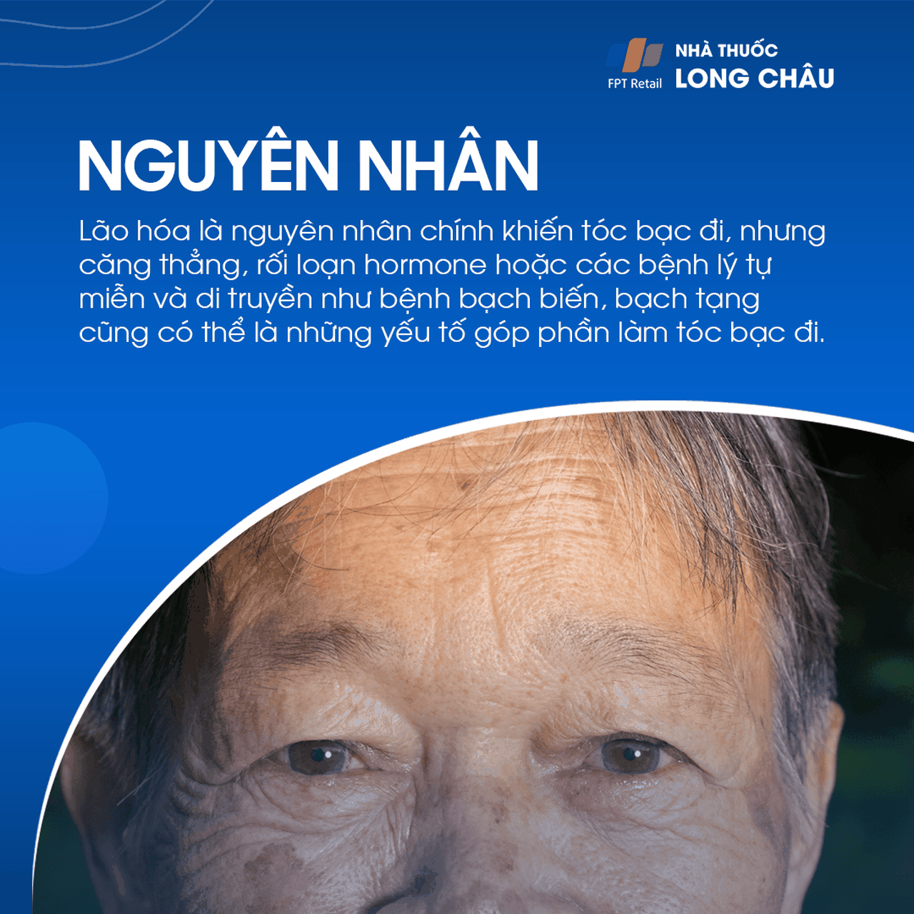 Tóc bạc sớm 3