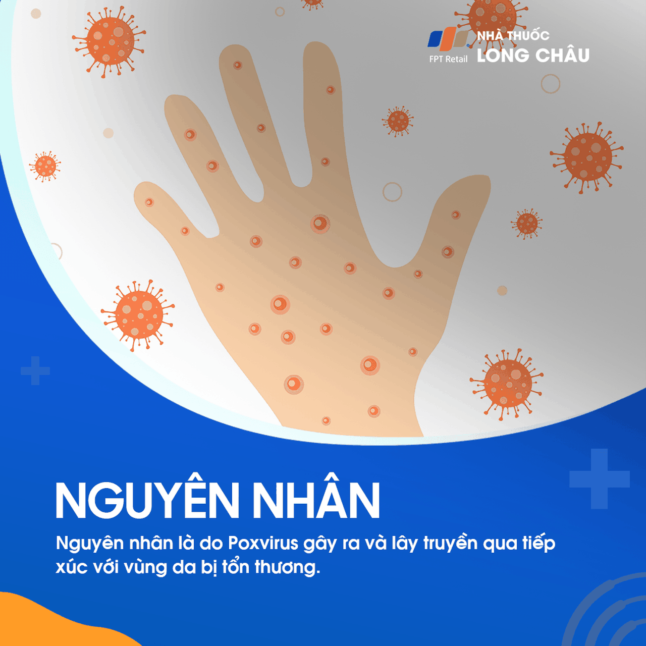 U mềm lây 3