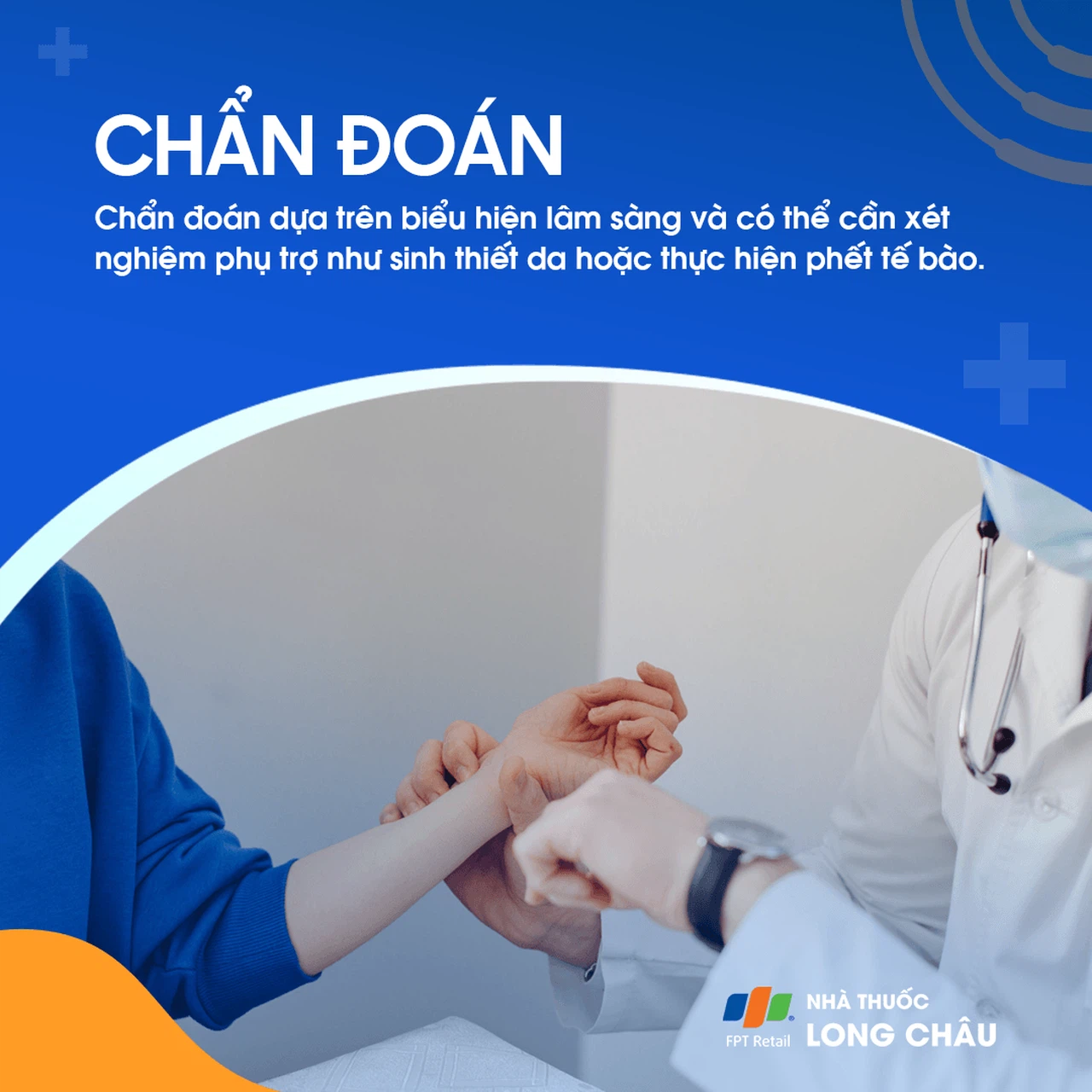 U mềm lây 5