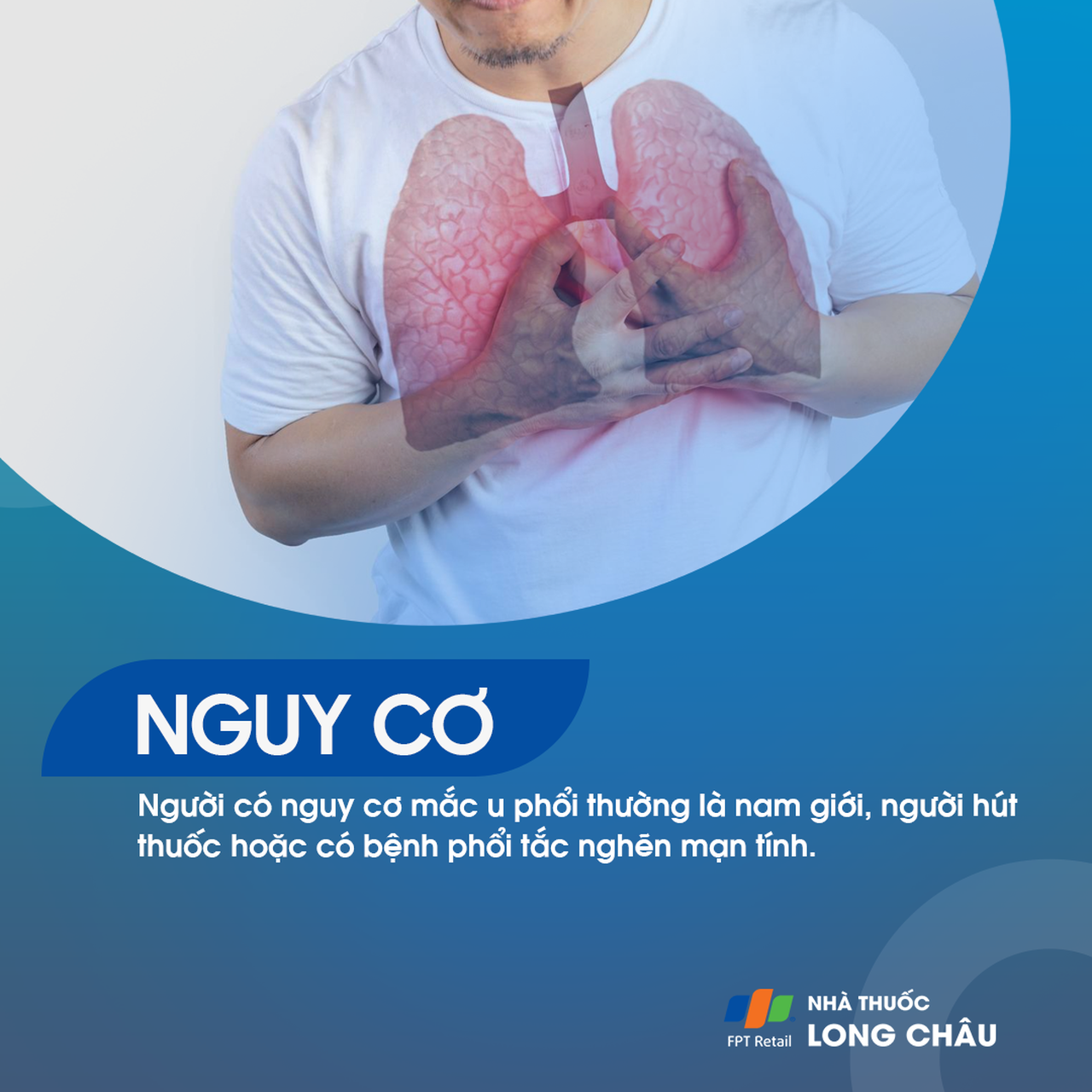 U phổi 4