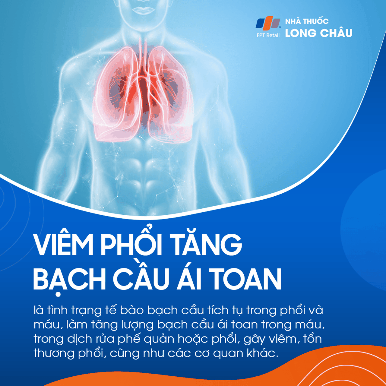 Viêm phổi tăng bạch cầu ái toan 1