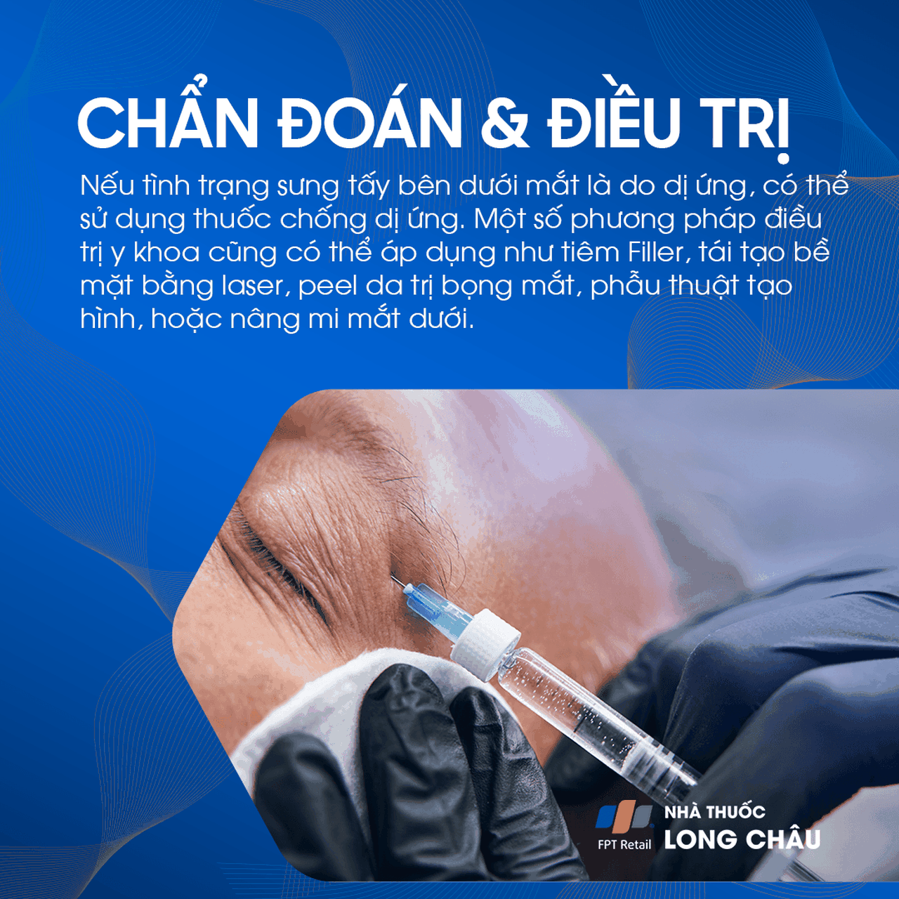 Bọng mắt 6