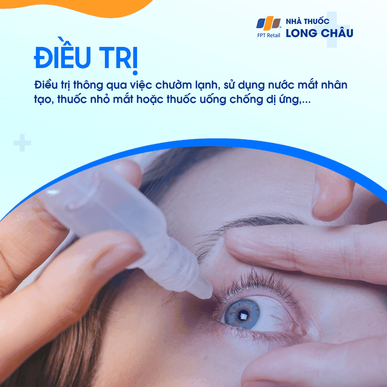 Ngứa mắt 6
