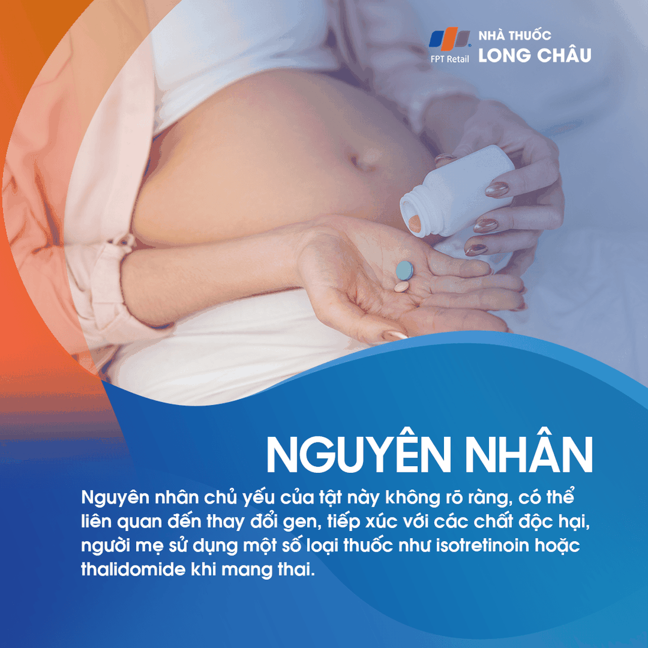 Tật không nhãn cầu 3