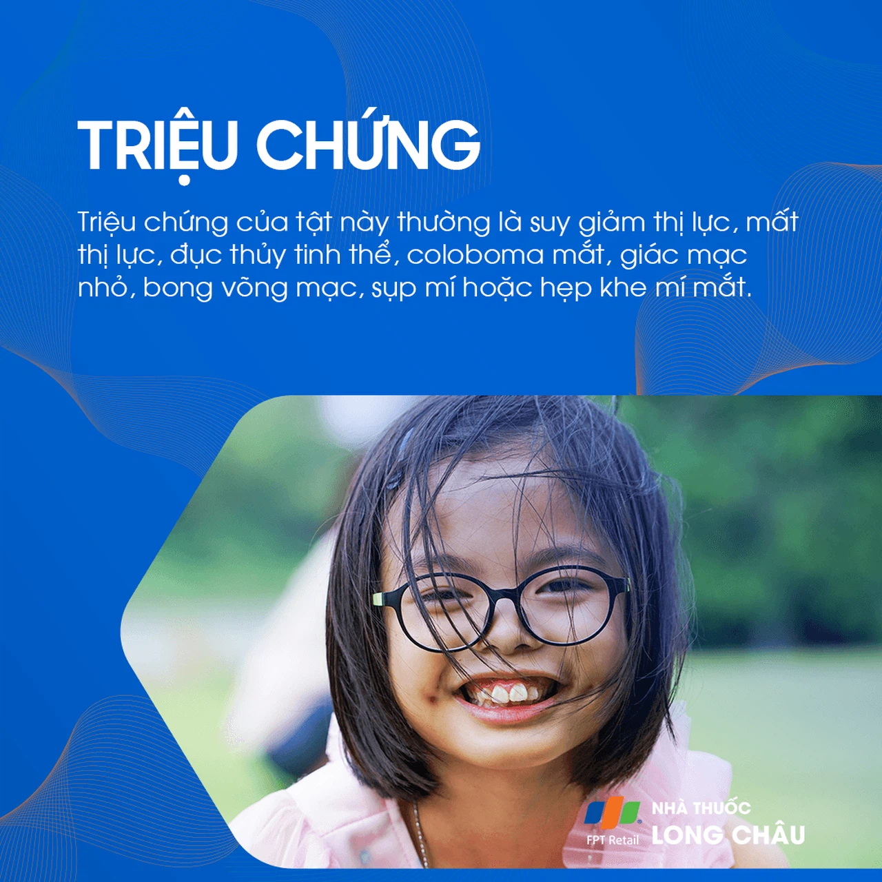 Tật mắt nhỏ 2