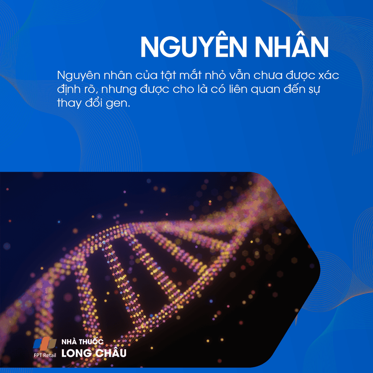 Tật mắt nhỏ 3