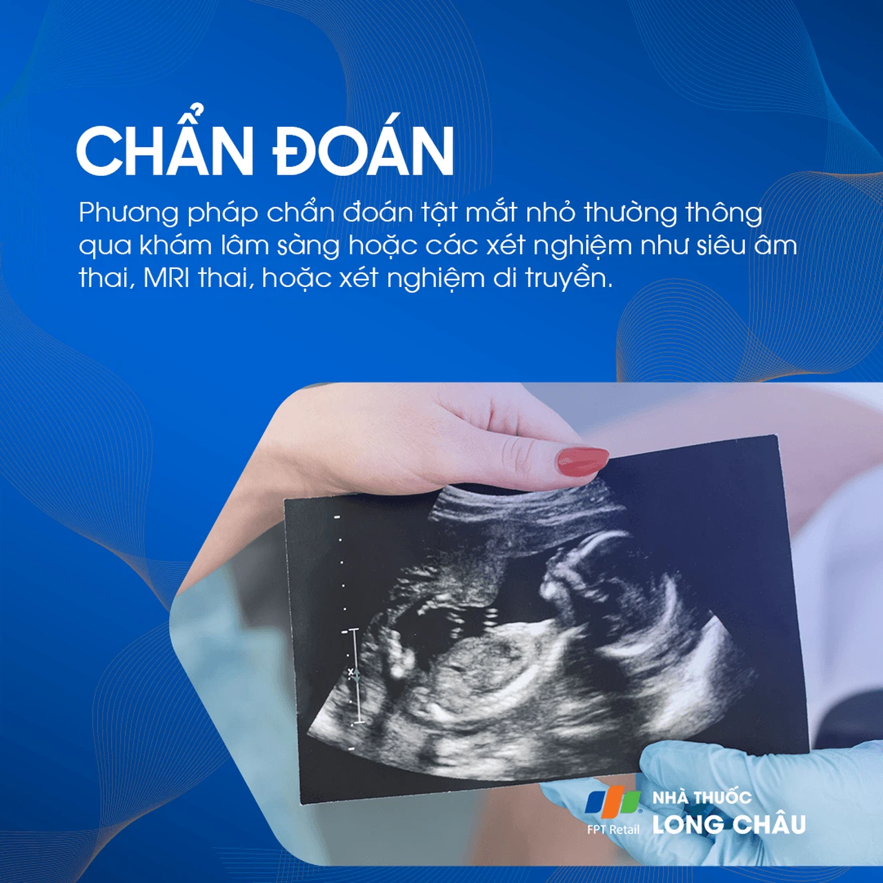 Tật mắt nhỏ 5