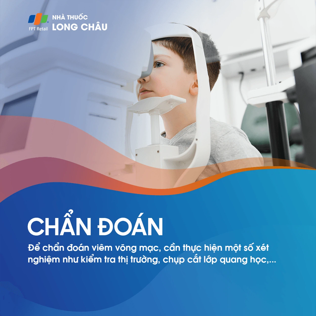 Viêm võng mạc 5