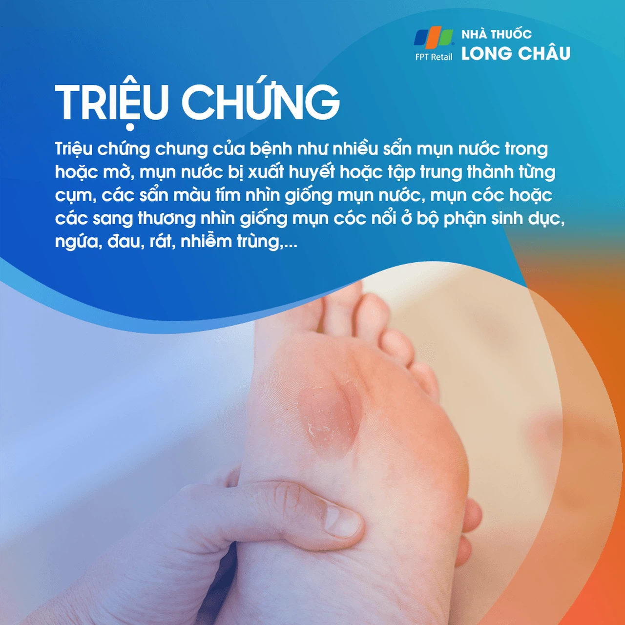 U bạch huyết 2