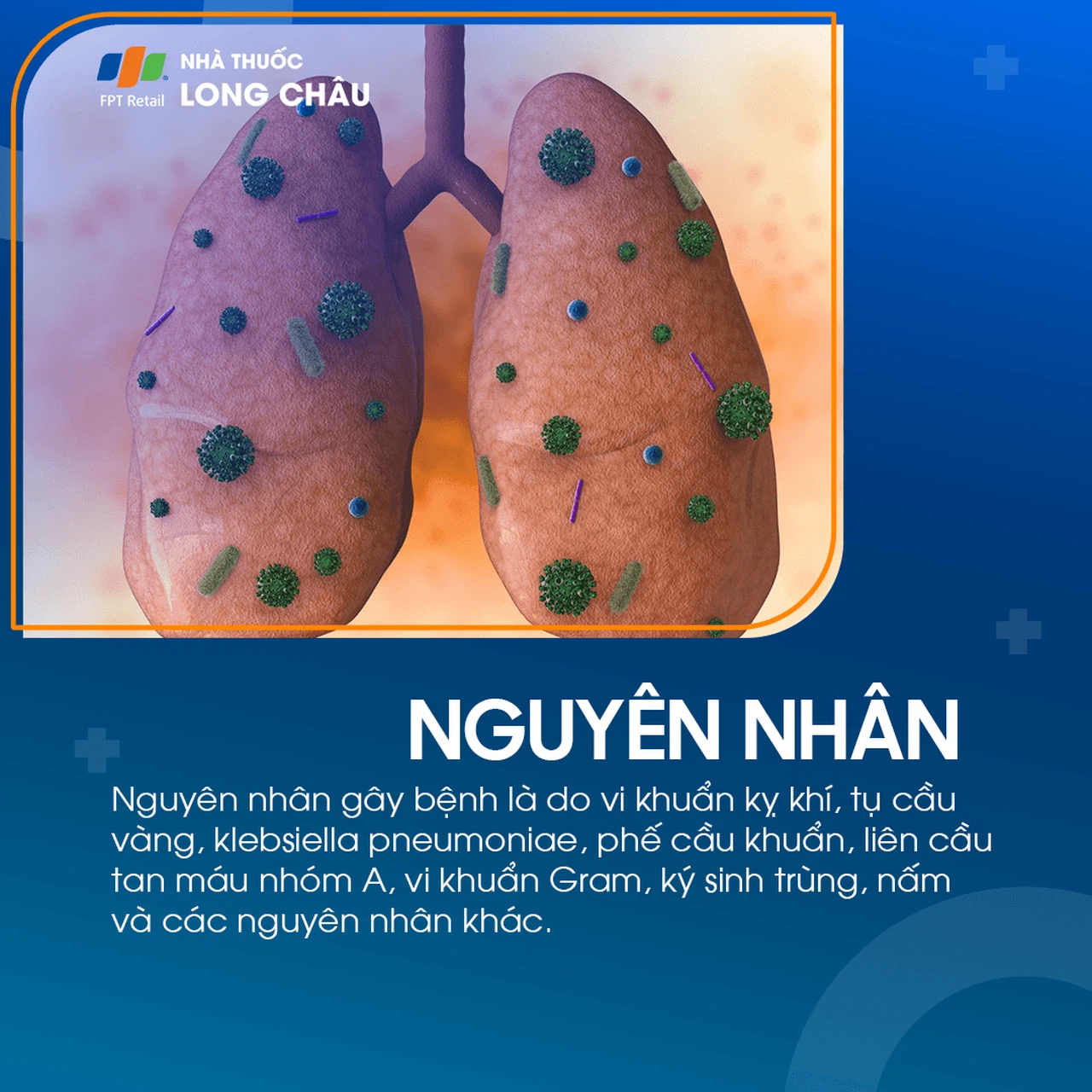 Áp xe phổi 3