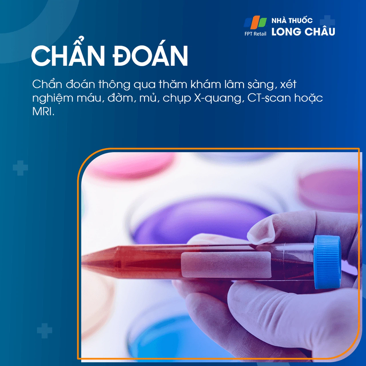 Áp xe phổi 5