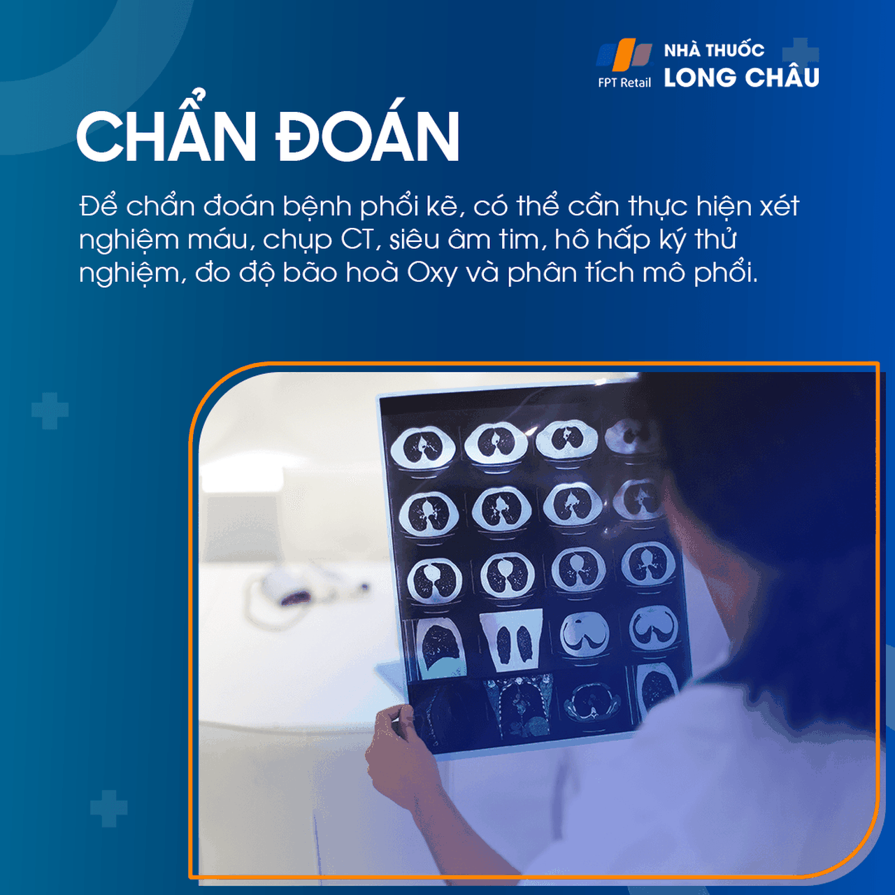 Phổi mô kẽ 5