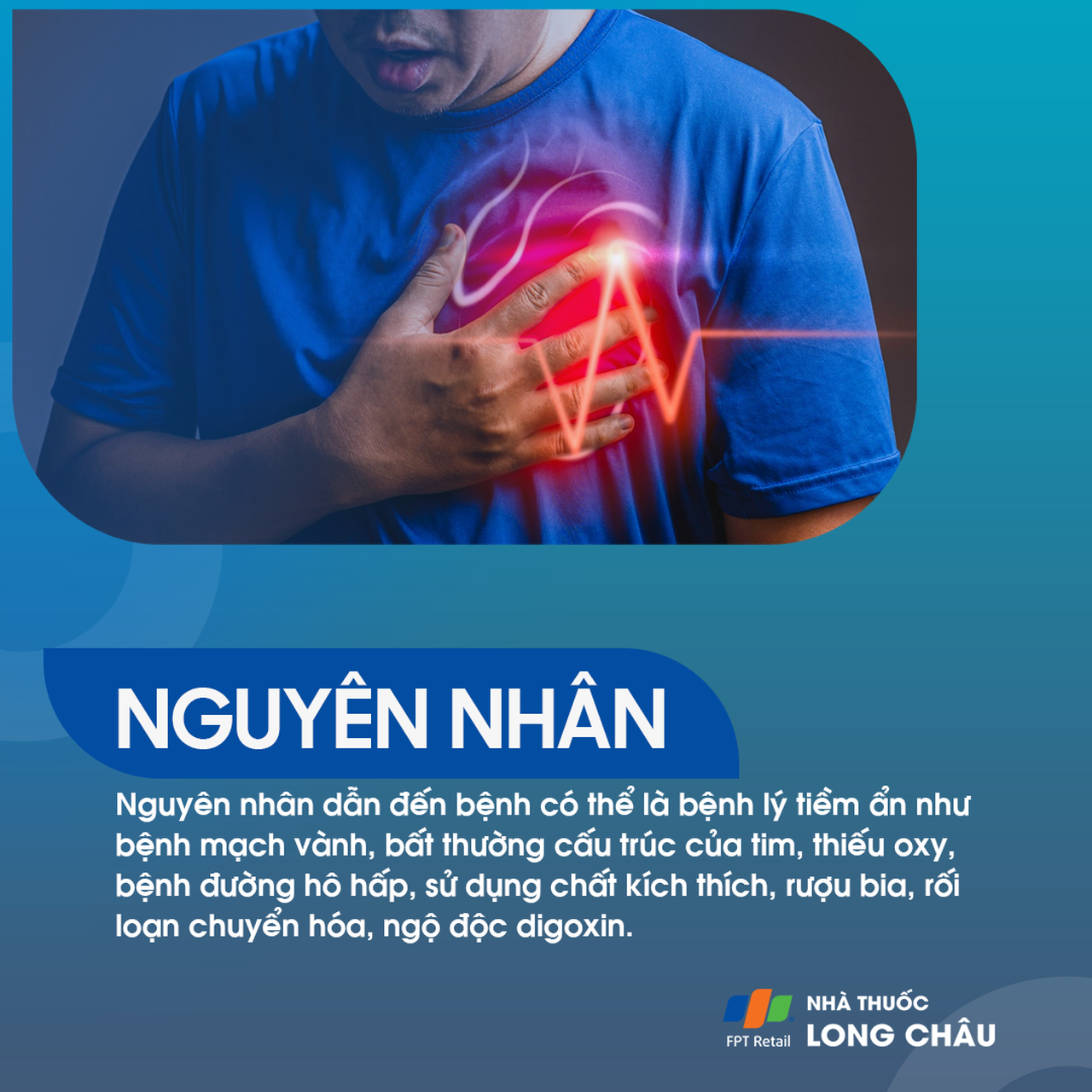 Nhịp nhanh nhĩ 3