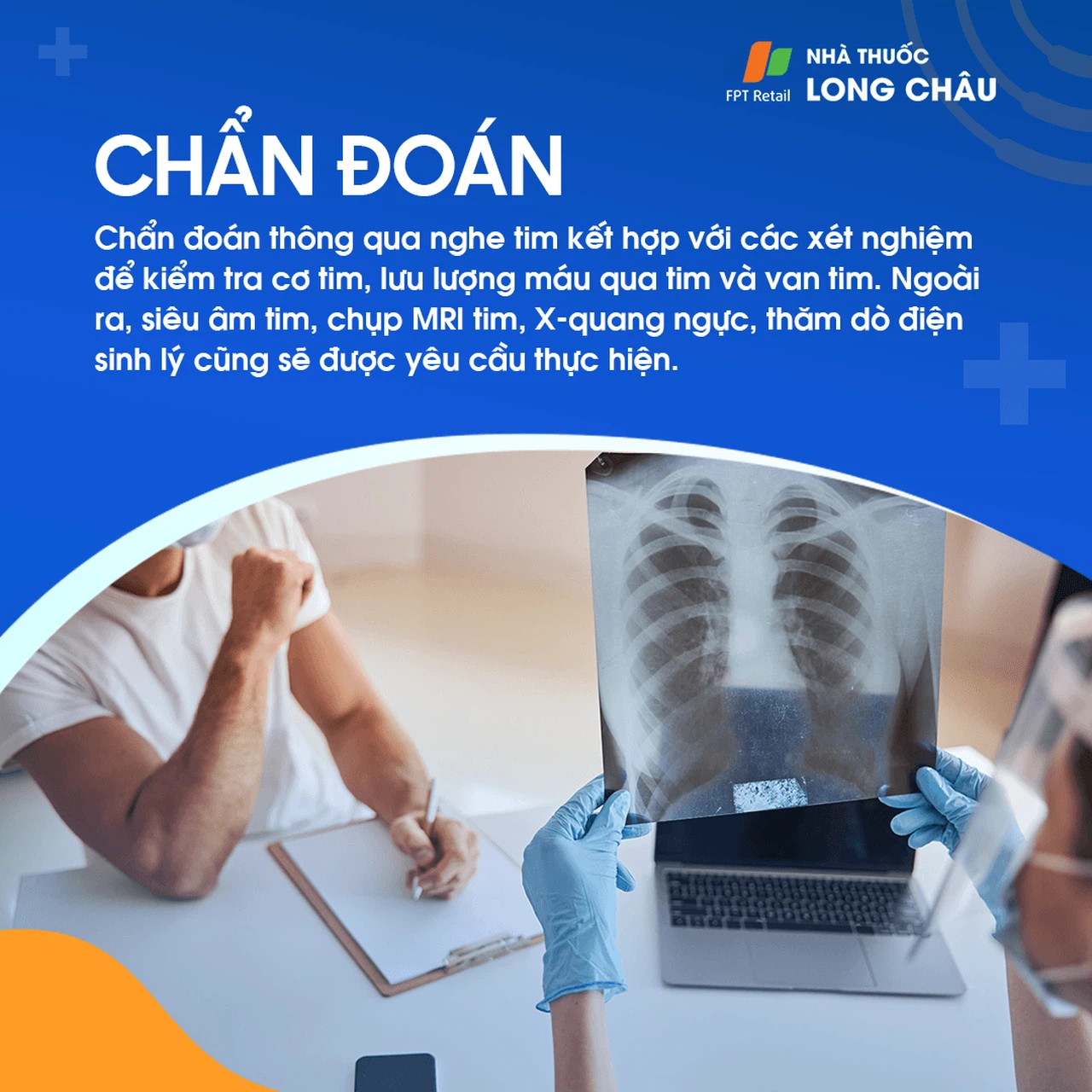 Tái cực sớm 6