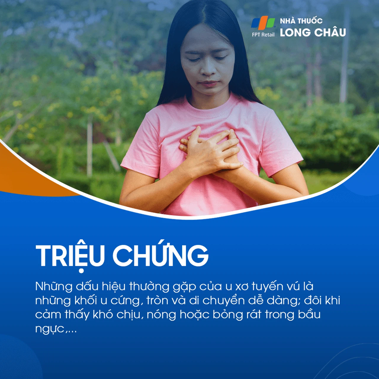 U xơ tuyến vú 2