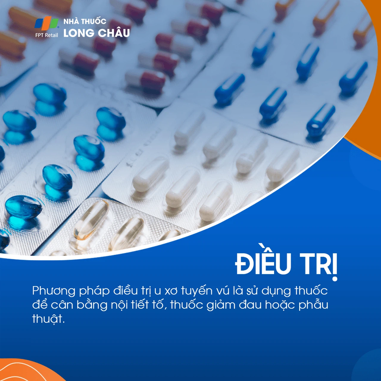 U xơ tuyến vú 6