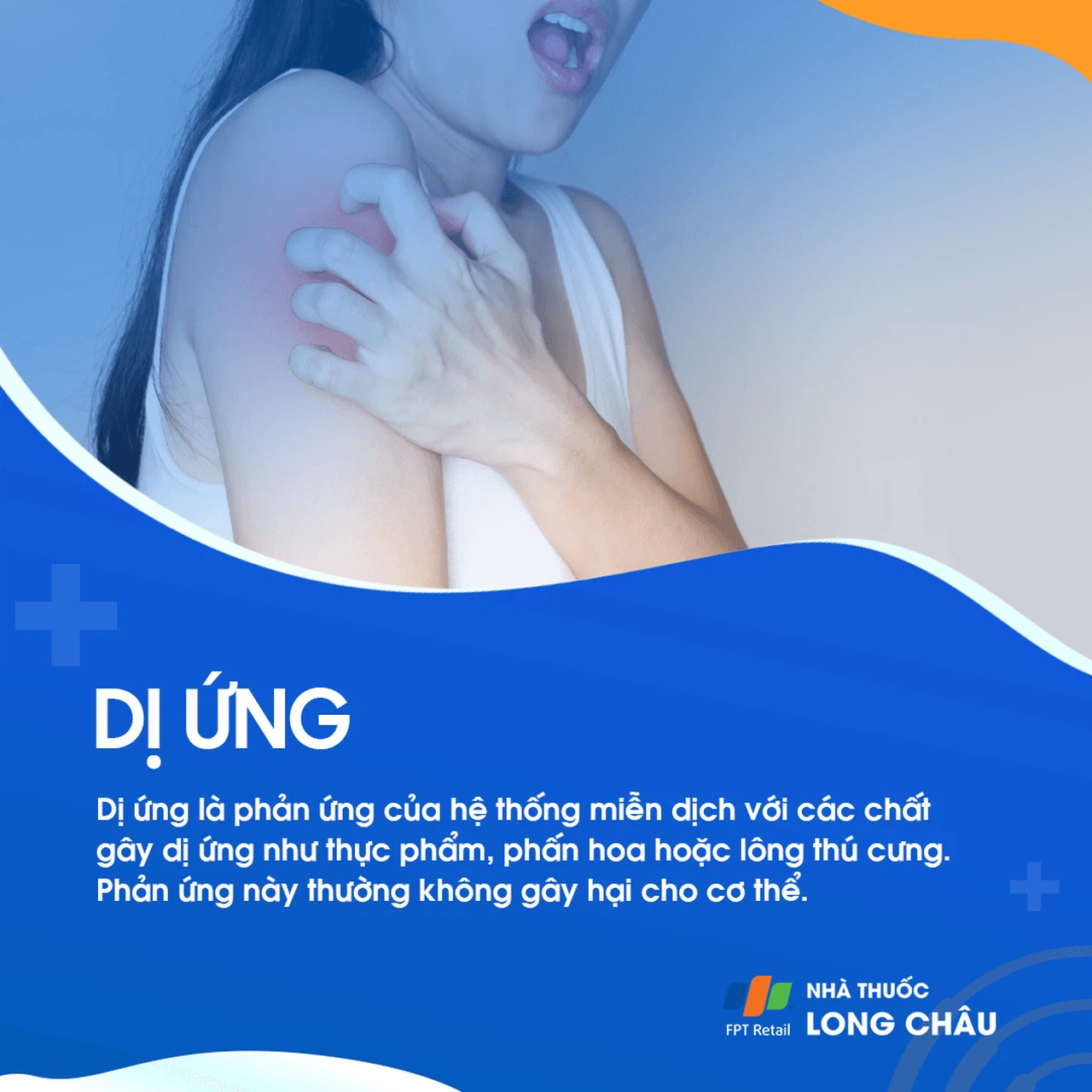 Bệnh dị ứng 1