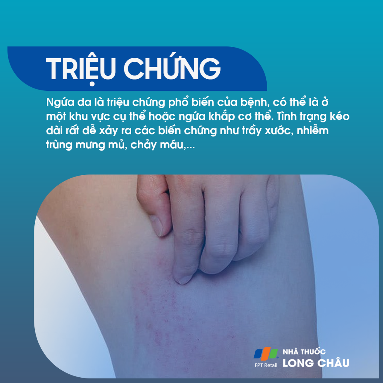 Ngứa da 2