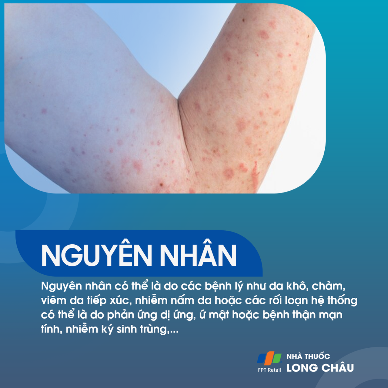 Ngứa da 3