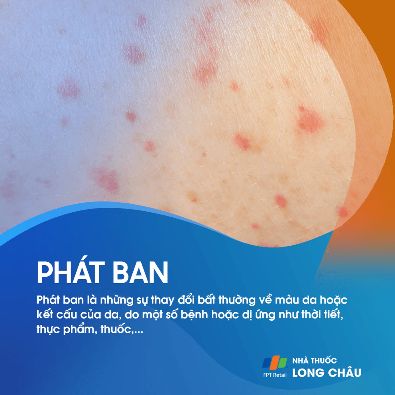Phát ban 1