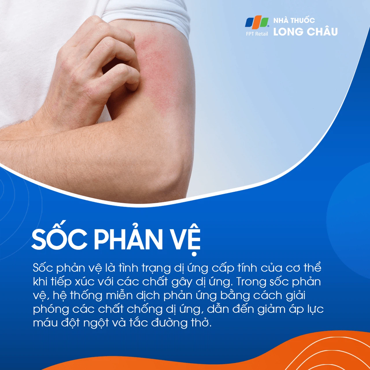 Sốc phản vệ 1